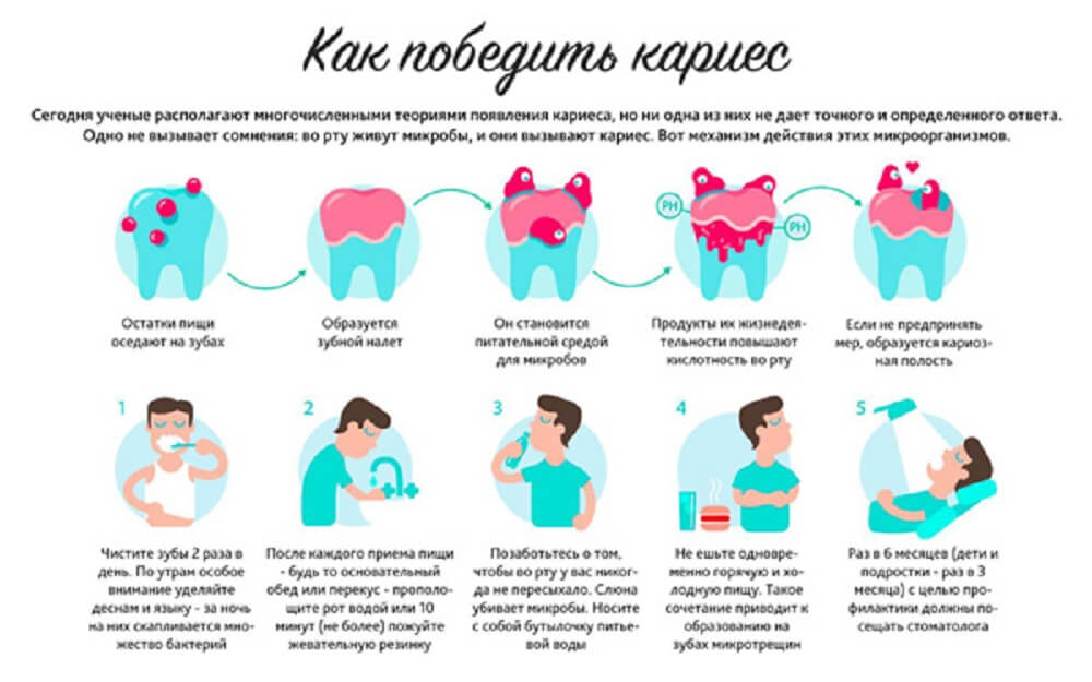 infografika-kak-pobedit-karies