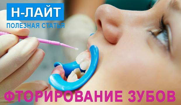 Простое и глубокое фторирование зубов: особенности процедуры