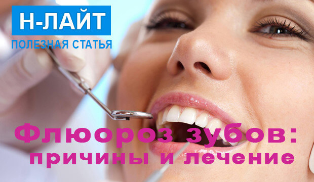 Флюороз зубов: причины, формы и лечение