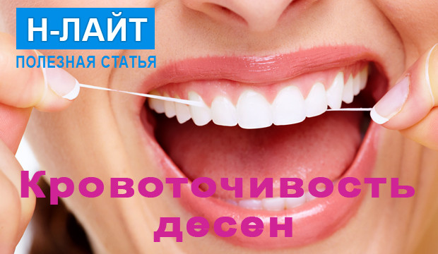 Кровоточивость десен