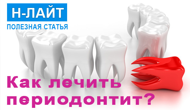 Как лечить периодонтит?