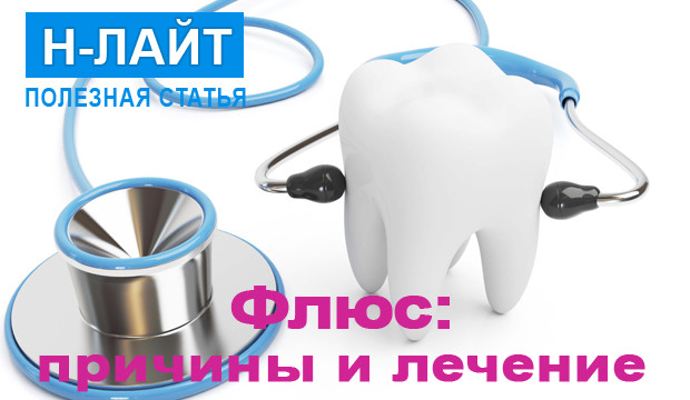 Флюс: причины и лечение