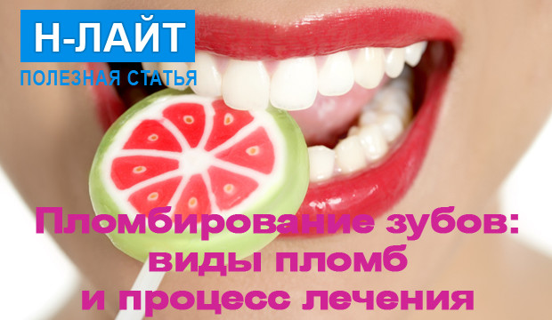 Пломбирование зубов: виды пломб и процесс лечения