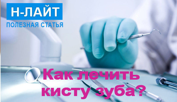 Как лечить кисту зуба?