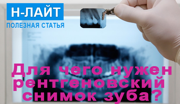 Для чего нужен рентгеновский снимок зуба?