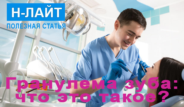 Гранулема зуба – что это такое?