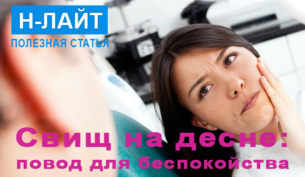 Свищ на десне – повод для беспокойства!