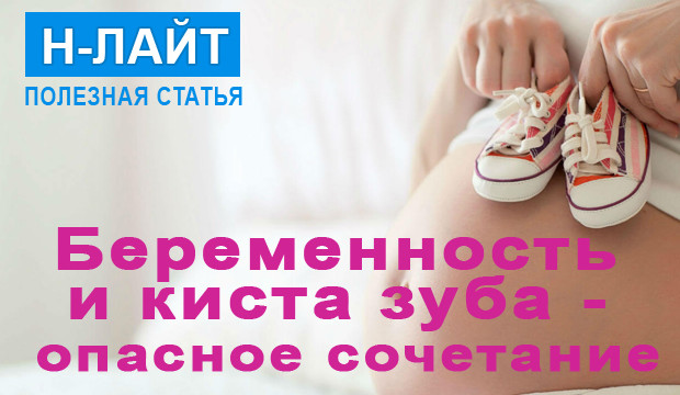 Беременность и киста зуба – опасное сочетание