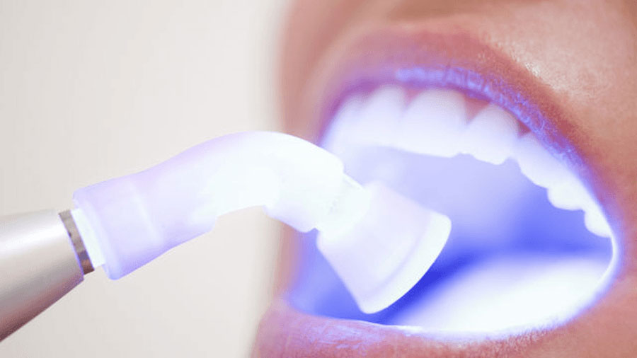 teeth-whitening-900