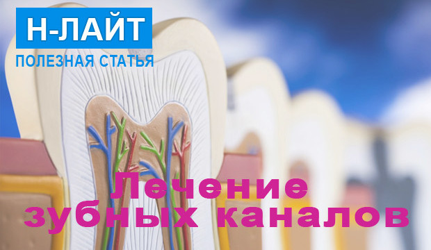 Лечение зубных каналов