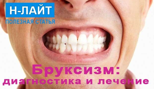 Бруксизм, скрежет или скрип зубами