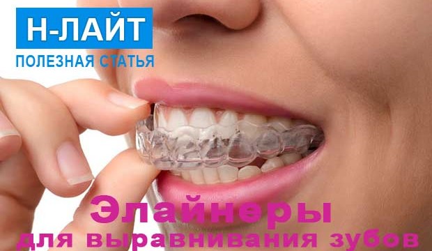 Элайнеры для выравнивания зубов – альтернатива брекетам!