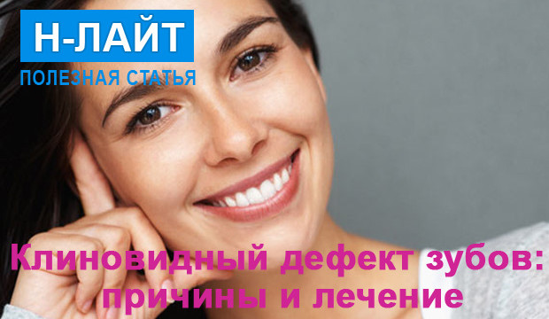Клиновидный дефект зубов: причины и лечение