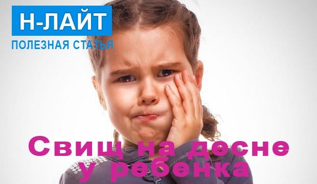 Свищ на десне у ребенка