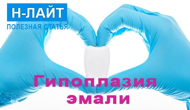 Гипоплазия эмали