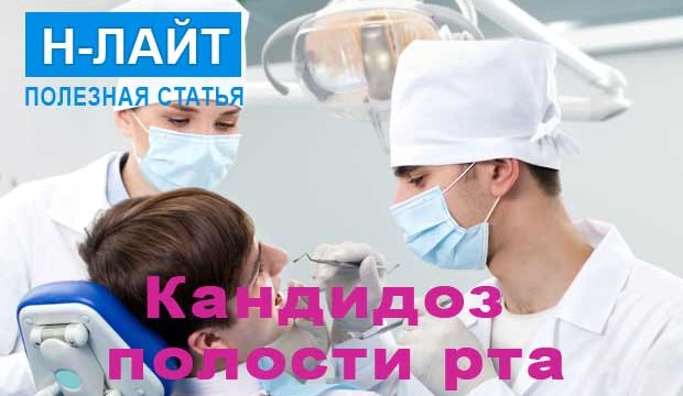 Кандидоз полости рта