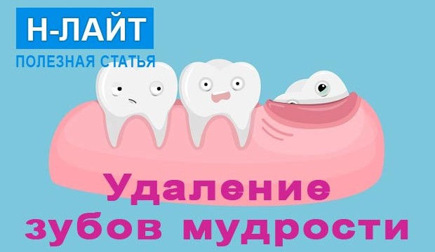 Нужно ли удалять зубы мудрости