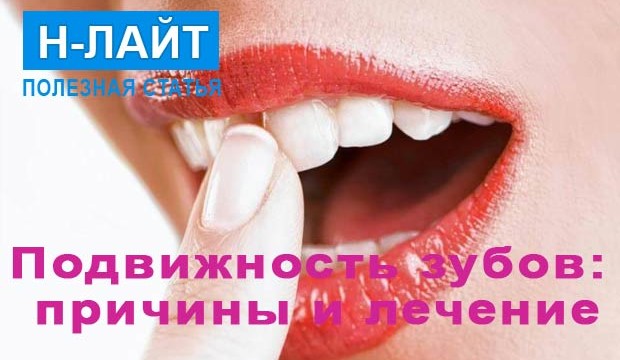 Подвижность зубов: причины и лечение