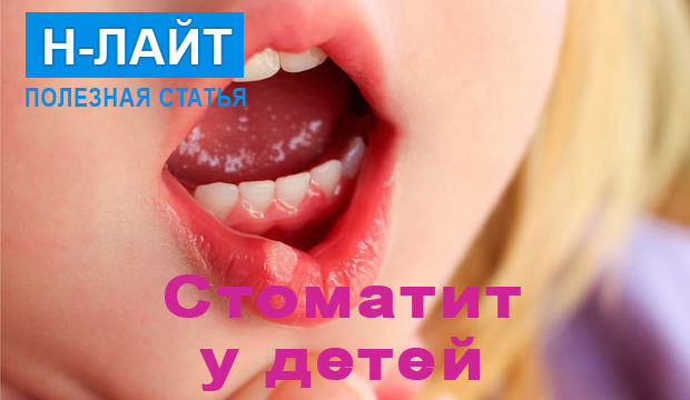 Острые стоматиты у детей