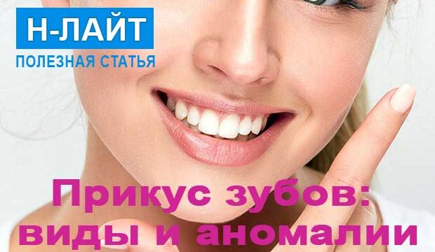 Прикус зубов человека — виды и аномалии