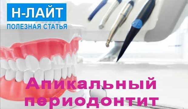 Апикальный периодонтит