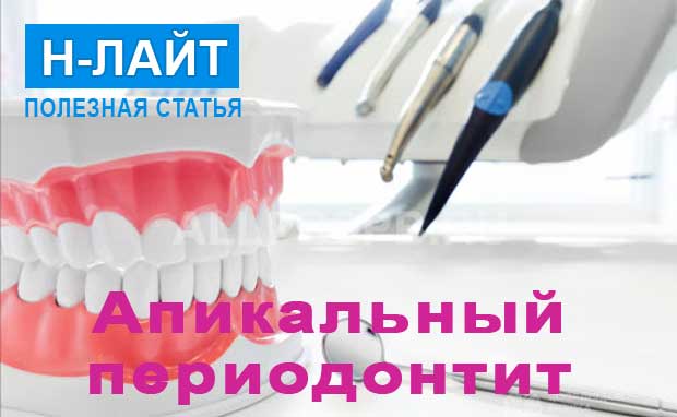 Апикальный периодонтит