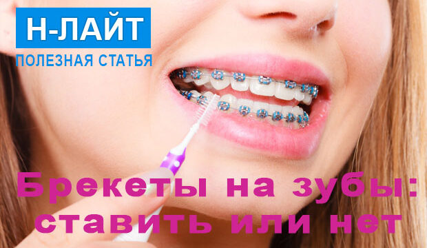 Брекеты на зубы – ставить или нет