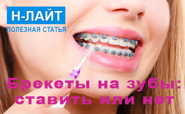 Брекеты на зубы – ставить или нет