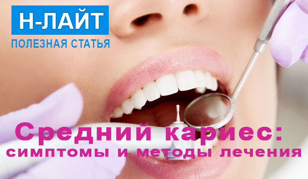 Средний кариес: симптомы и методы лечения