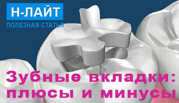 Зубные вкладки вместо пломбы: плюсы и минусы