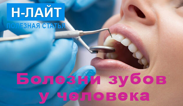 Болезни зубов у человека