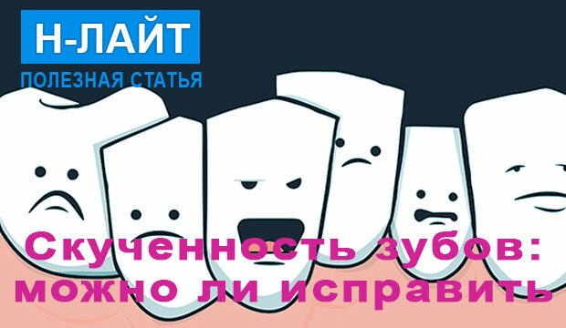 Скученность зубов – можно ли исправить