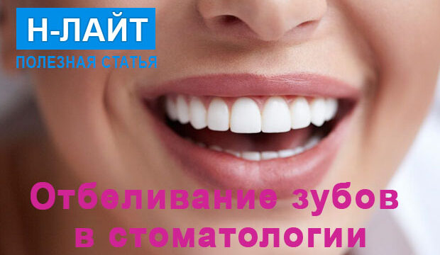 Отбеливание зубов в стоматологии